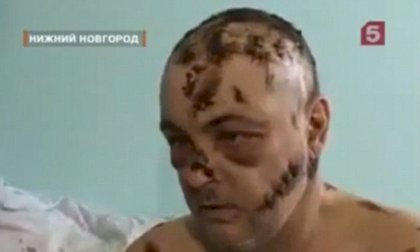 krokodil addiction.jpg