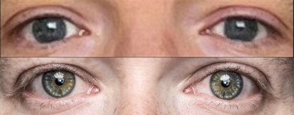 bernd_eyes_mark_eyes.JPG
