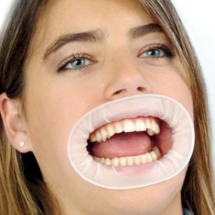 60PCS-Pack-Grinigh-M-Size-White-Color-Non-Latex-Rubber-O-Shape-Dental-Cheek-Lip-Retractor.jpg_640x640.webp
