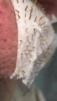 nose pores.mp4