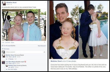 down syndrome blackpill.jpg
