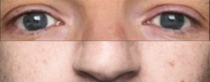 bernd_eyes_mark_nose.JPG