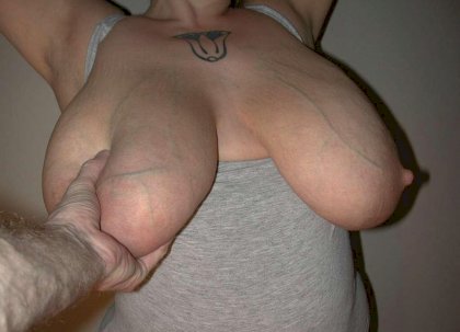 big-veiny-tits-huge-veins.jpg