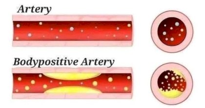 body positive artery.jpg