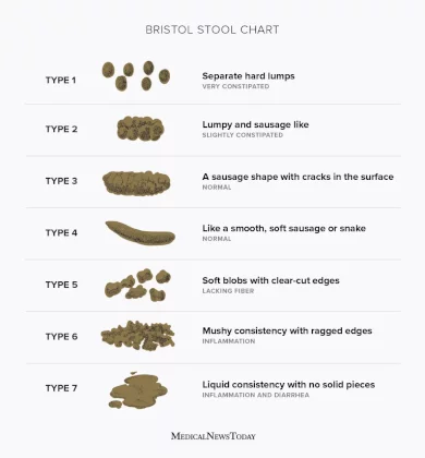 15970-bristol-stool-chart-1296x1394-english-body.webp