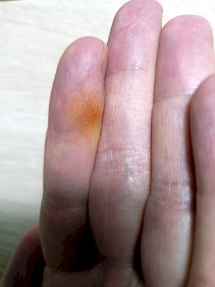 finger.jpg